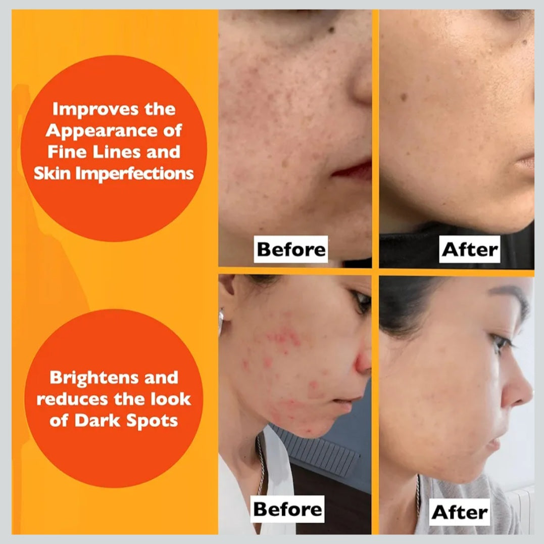 Organics Vitamin C Face Serum